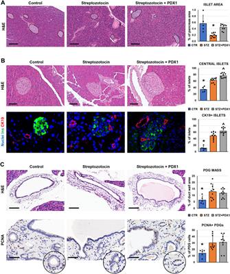 Islet Regeneration and Pancreatic Duct Glands in Human and Experimental Diabetes